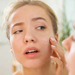 Cure Dry Skin: Effective Tips for Hydration and Relief