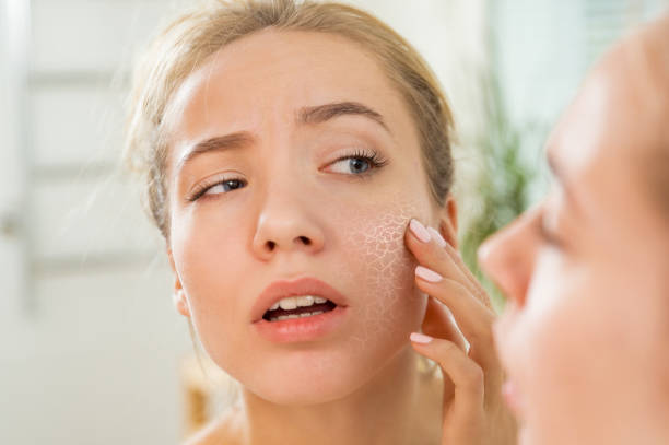 Cure Dry Skin: Effective Tips for Hydration and Relief